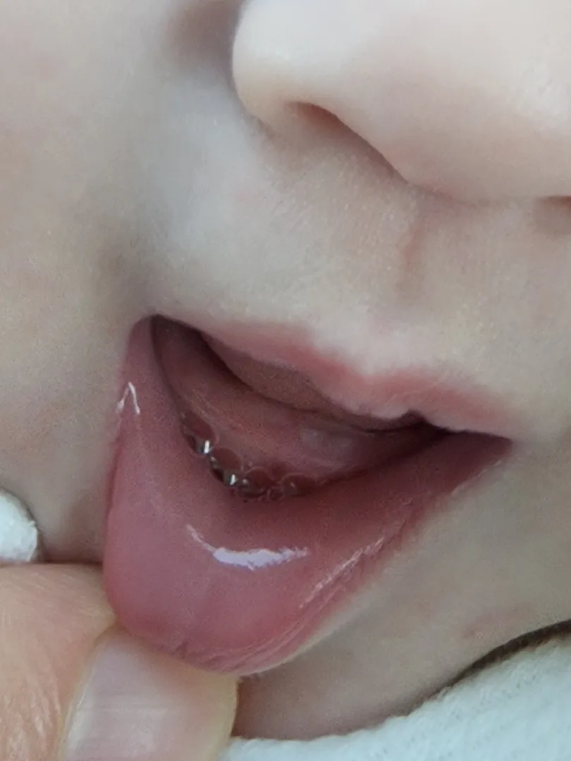 첫니 나왔네용~~🥹