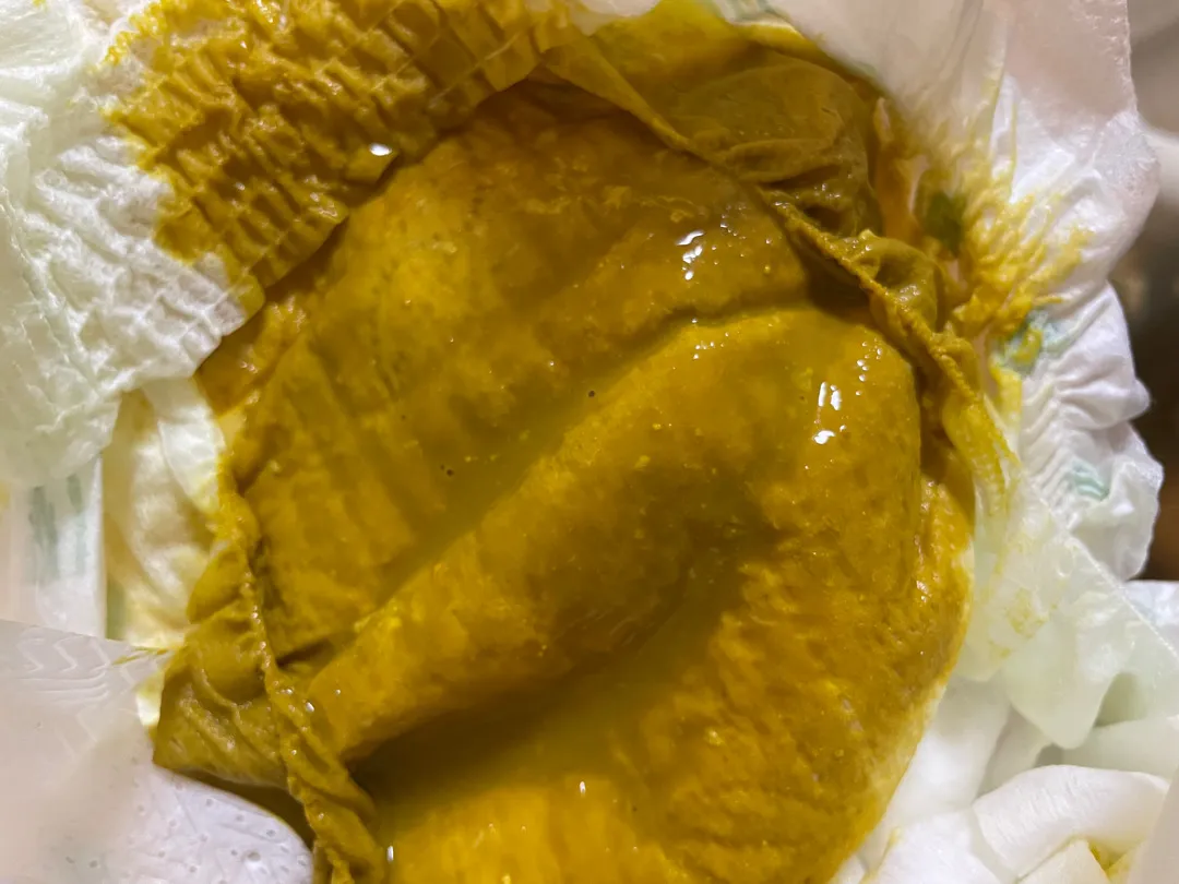 2개월 아기 설사일까요 (사진첨부, 사진주의)!!!