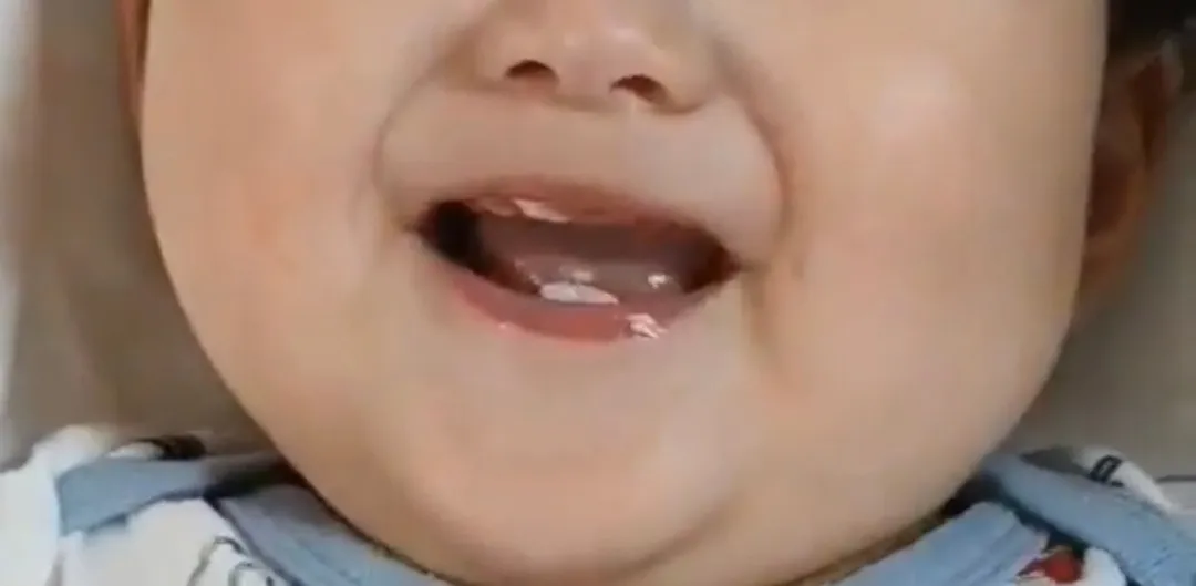 이앓이 지옥..🤦🏻‍♀️
