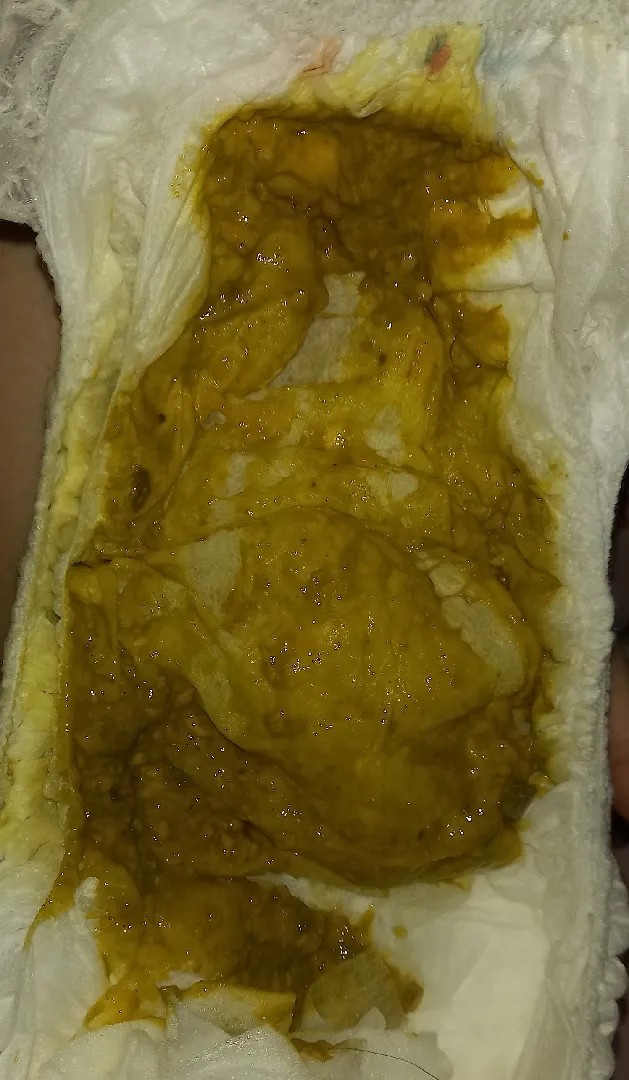 Ini diare apa bukan ya bun??