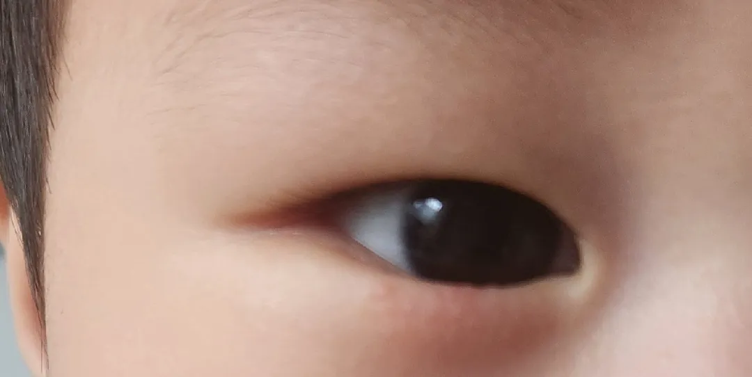 아기 눈