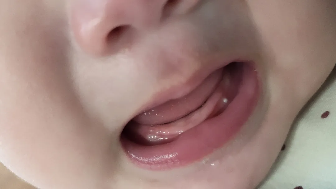 이앓이일까요ㅠ