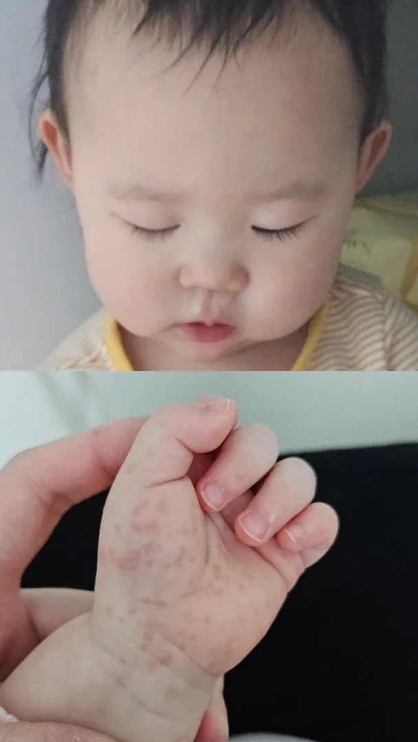 여기저기 성한데가 읍는 공듀😢