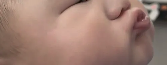 이나려는 신호? 및 증상있나요