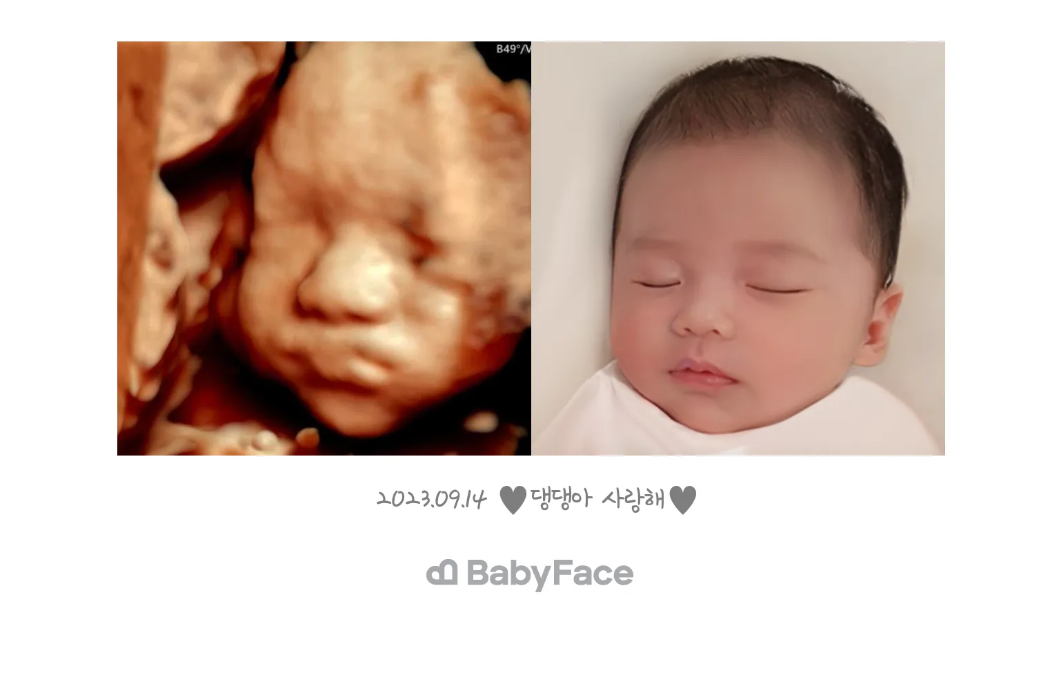 입초 성공쓰🫶🏻