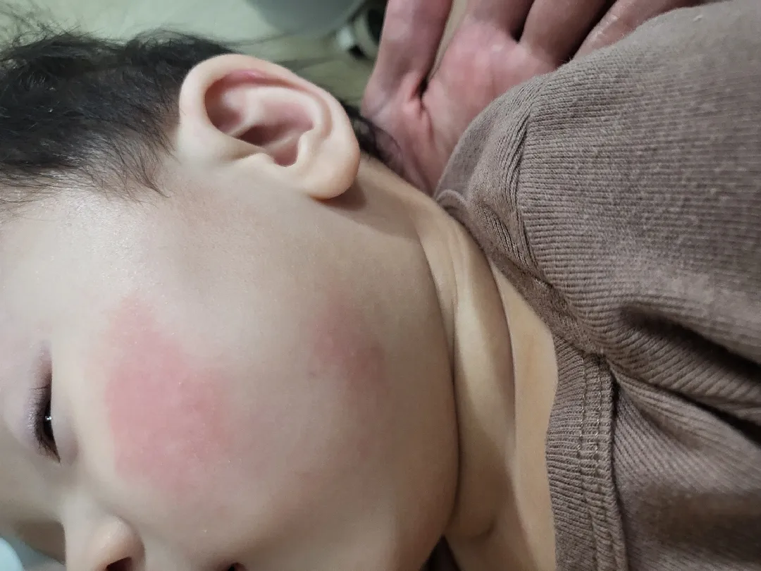 얼굴에 무언가 ? 생김
