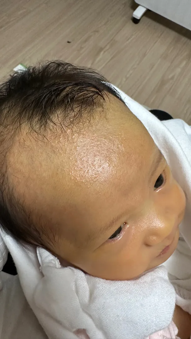 애기 피부