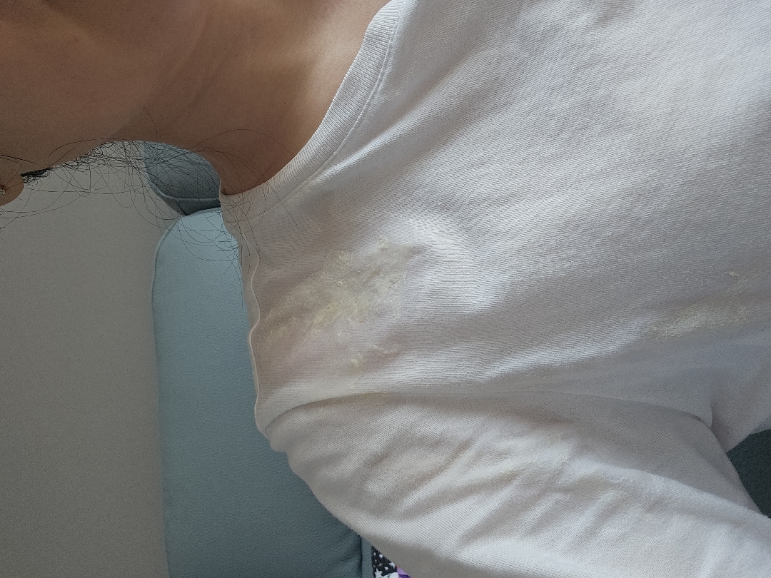 토 