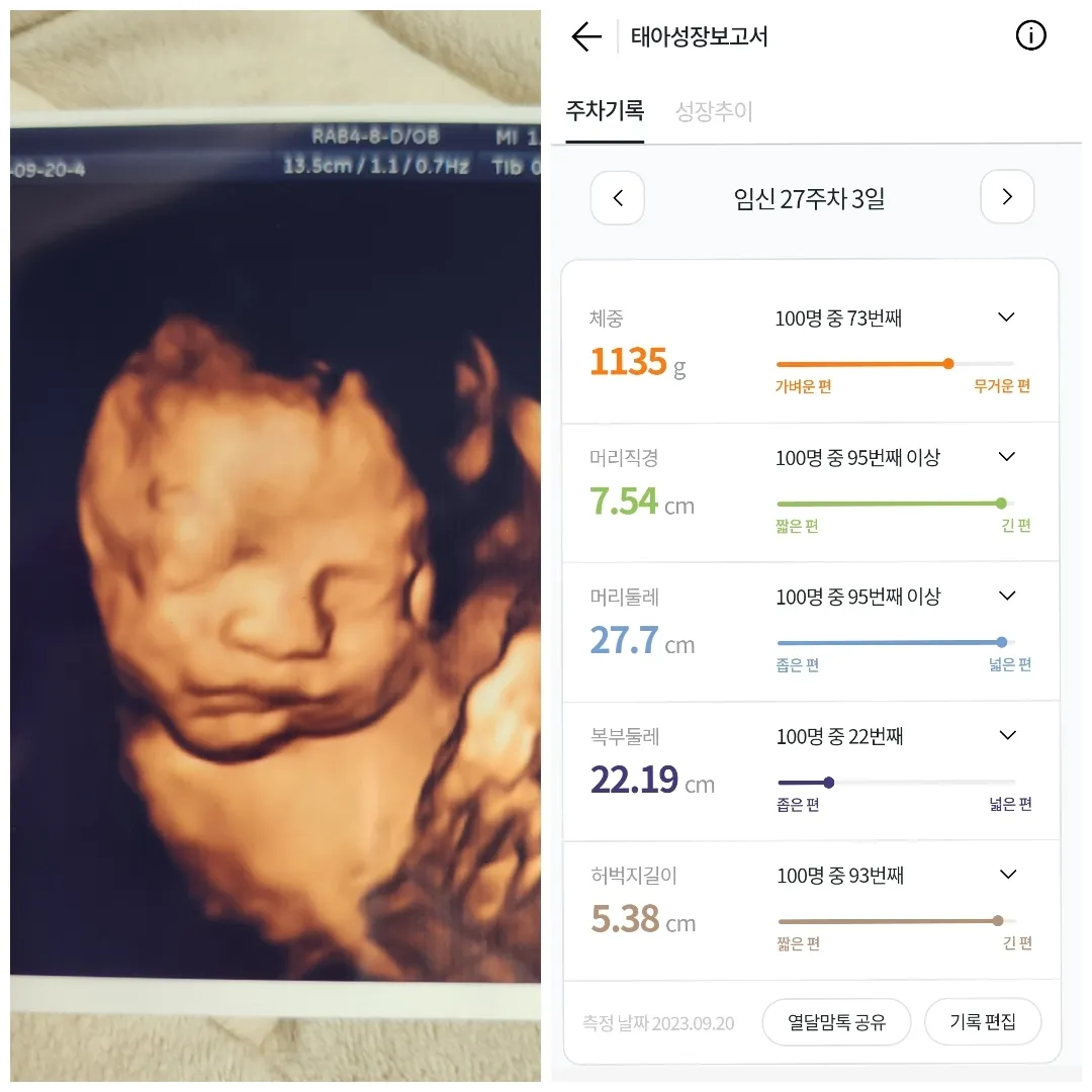 27주 입초보고왔어요 ㅎㅎ