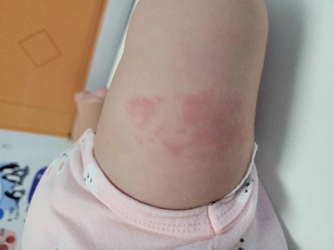 다리에 이게 뭘까요???