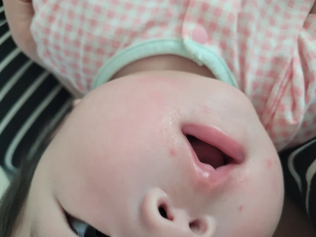 입 주위에 뭘까요?ㅠ