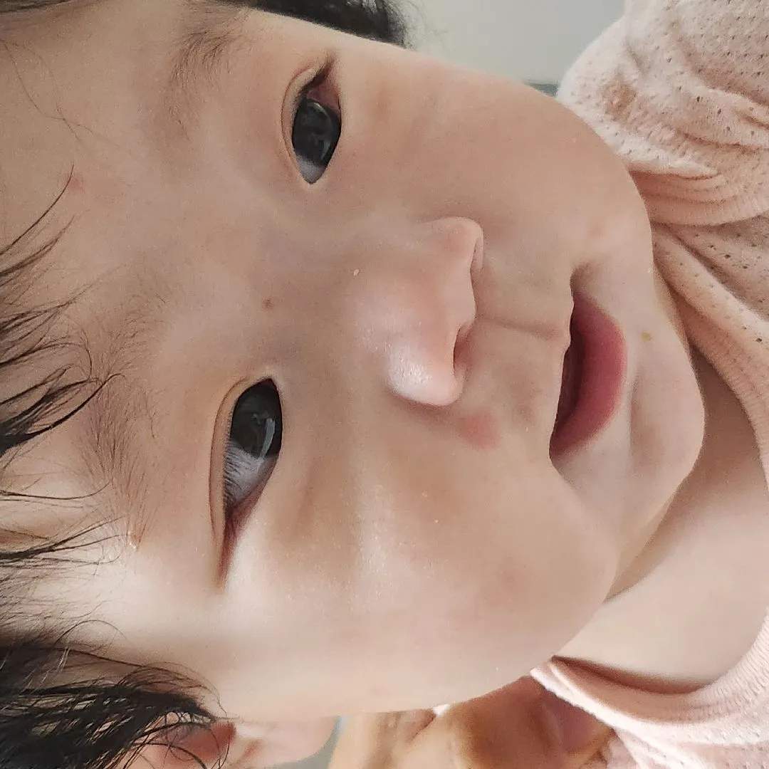 이유식 발진인지 봐주세용!!