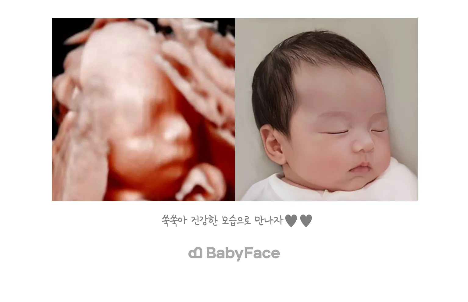 베이비페이스 했어요 