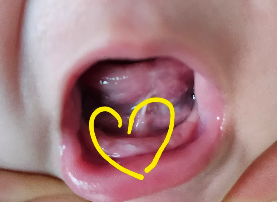 첫니가 났어요!