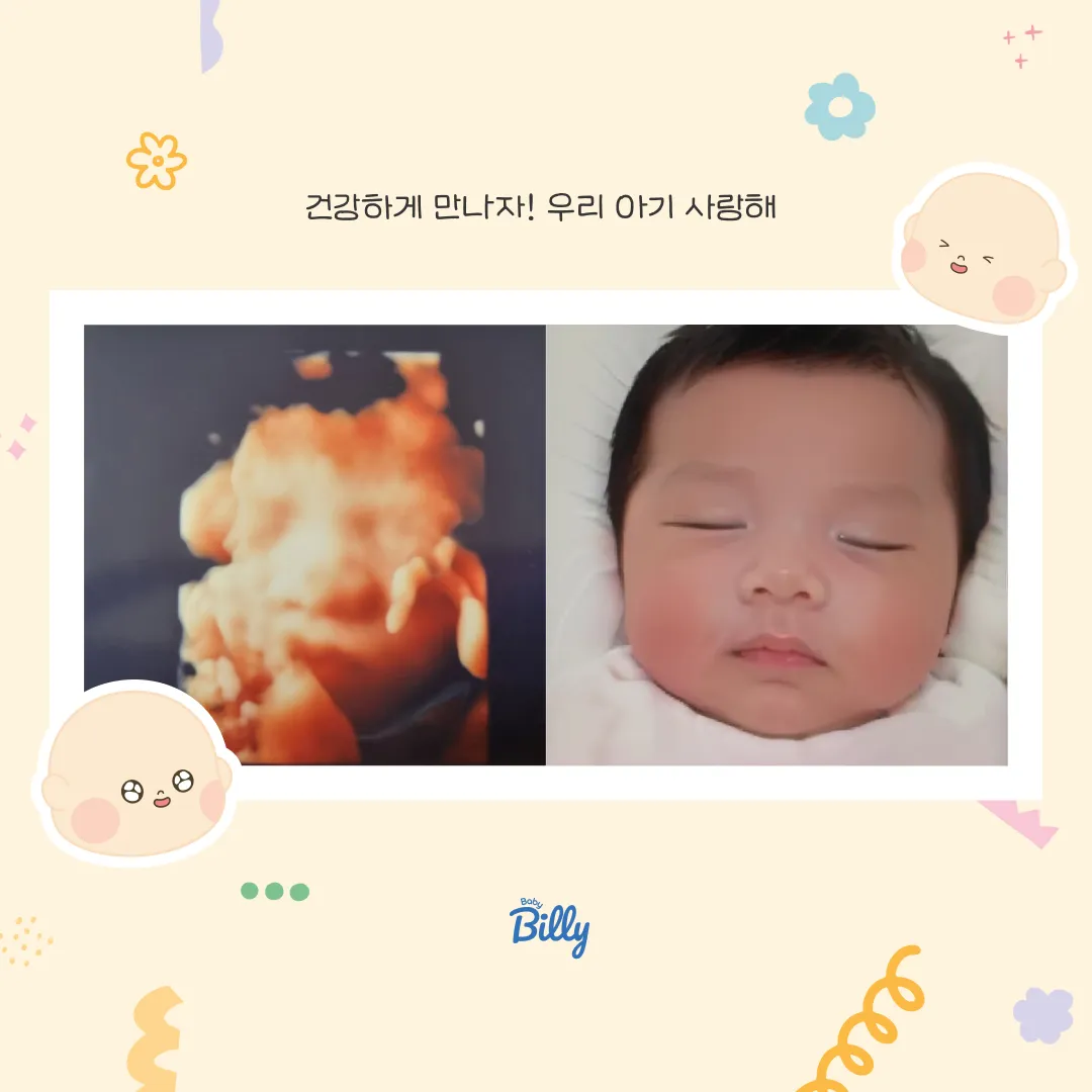 (당첨후기)아기얼굴예측당첨