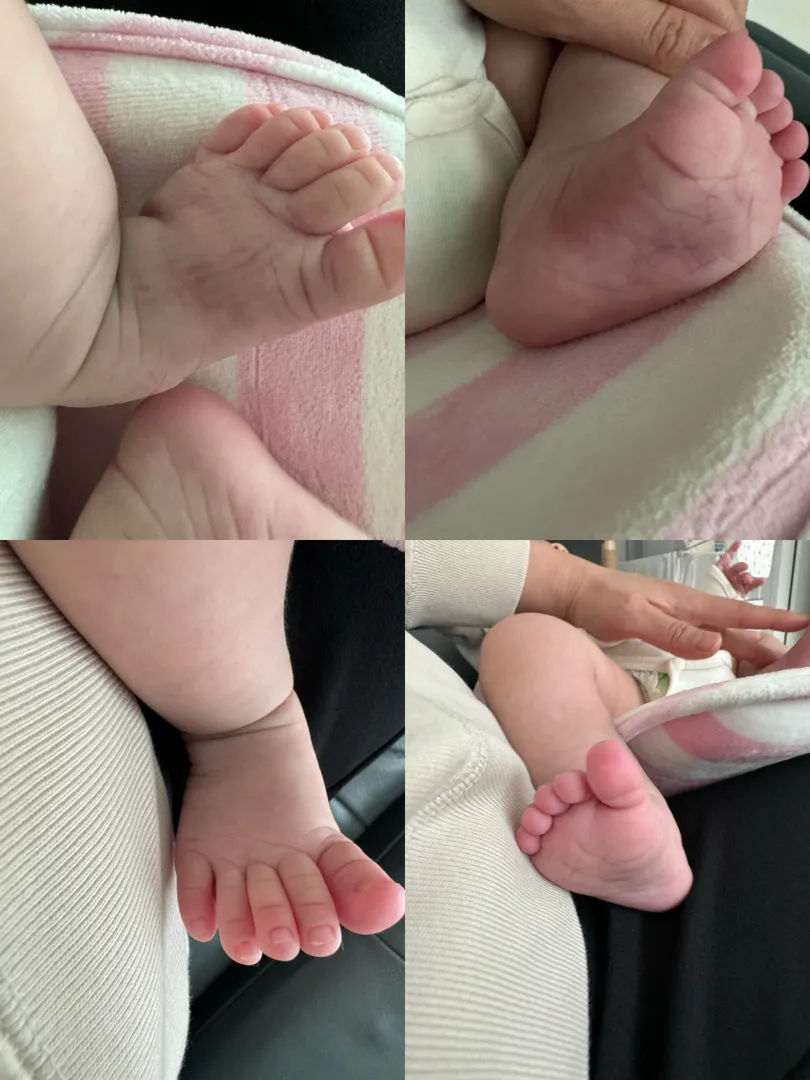 왼발 양말자국이 멍처럼 들었는데 안 없어져요