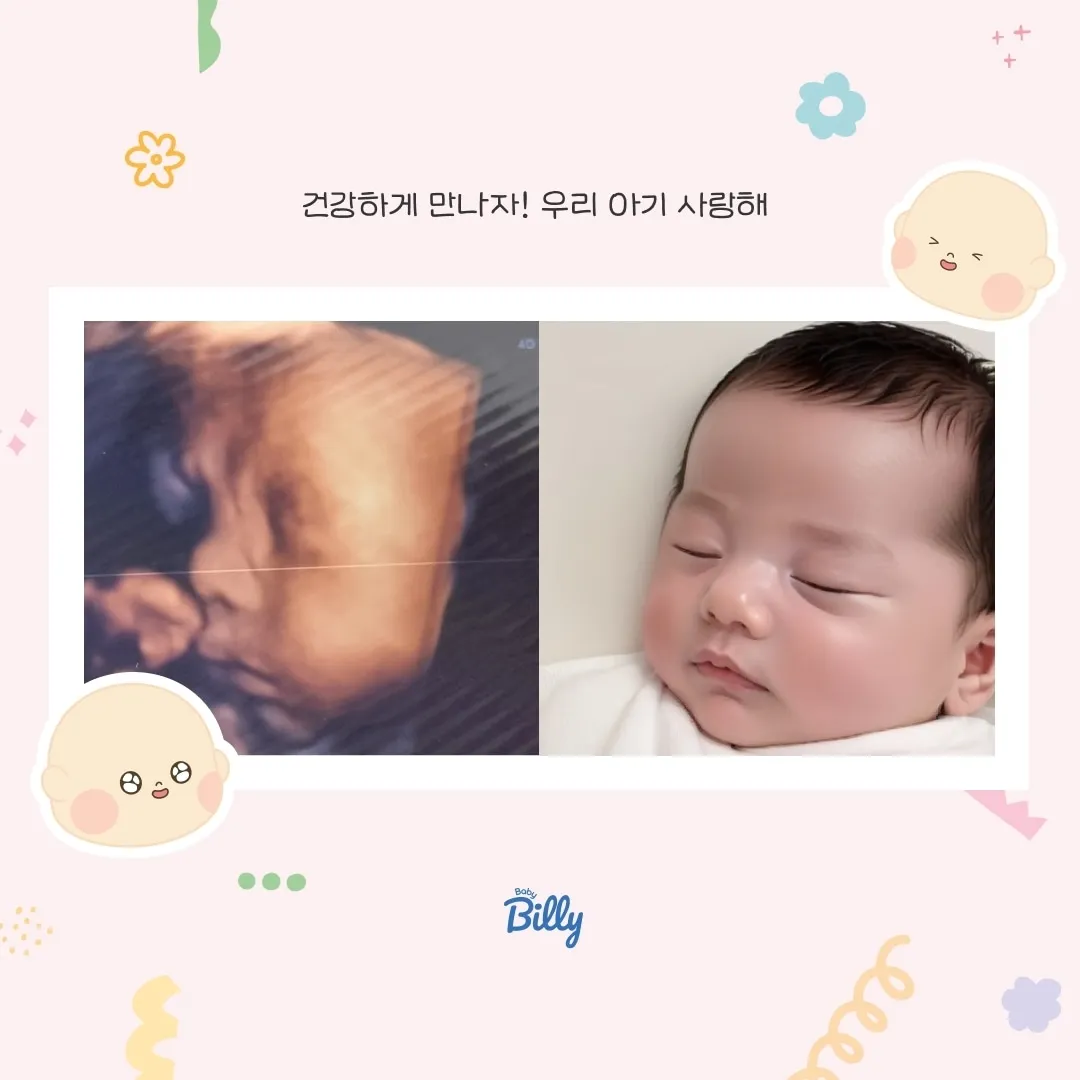 AI초음파예측사진😍