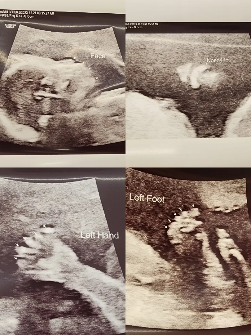 21주 5일