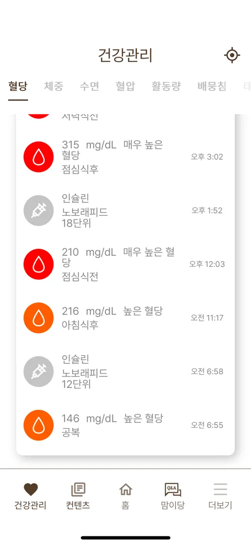 조기진통으류 입원