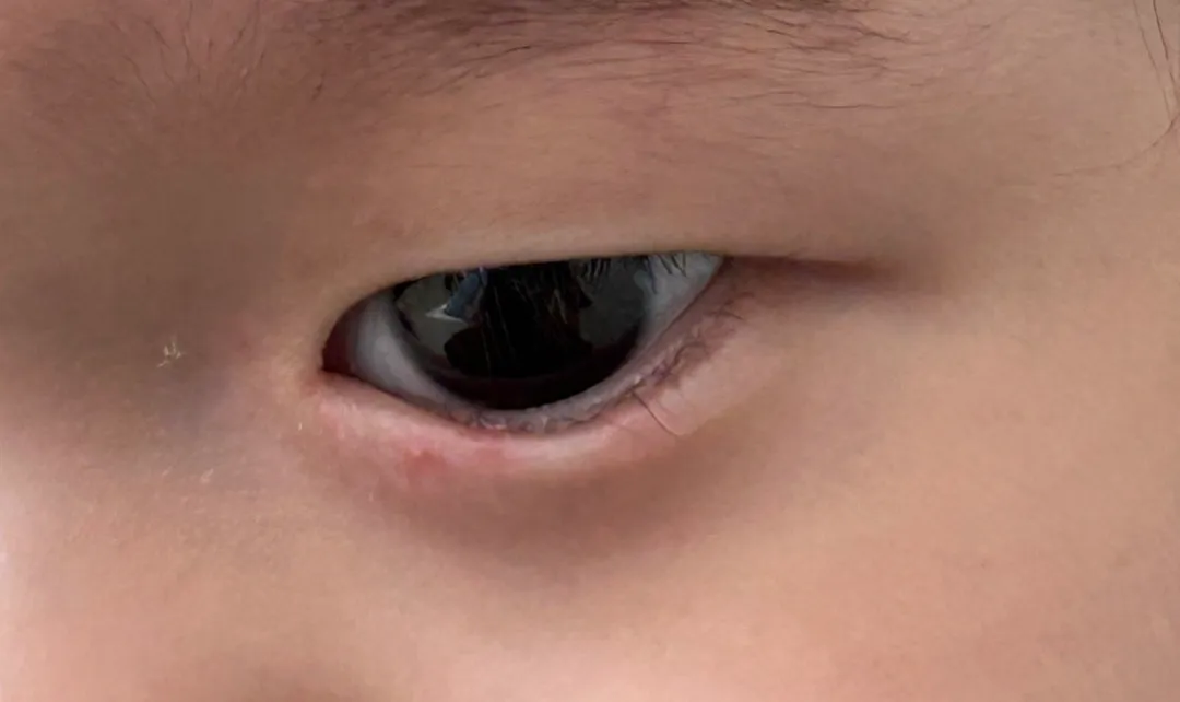 혹시 이거 알레르기일까요??