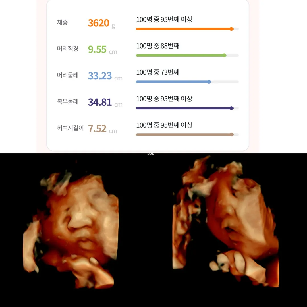 오늘 마지막 외래진료 보고왔어요! 드디어 담주네여 ㅠㅠ