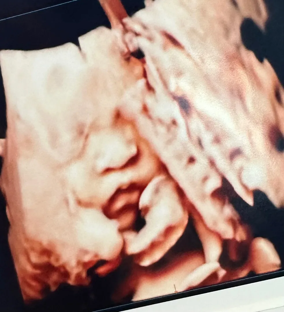 입초 재시도 성공했어요!!!:)