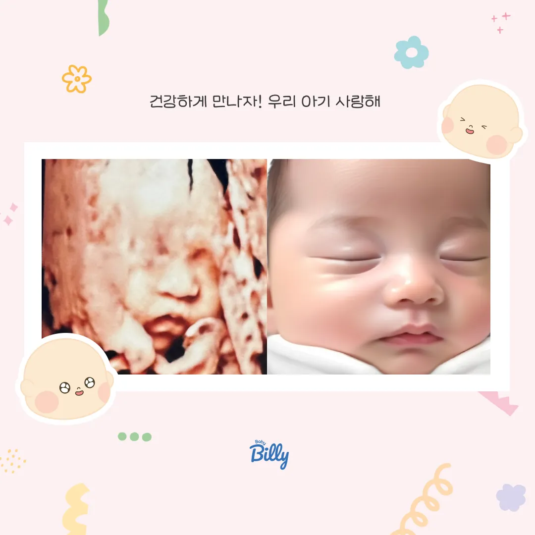 드디어 빌리에서 신청한 ai초음파 예측사진이왔어요!!!!❤️