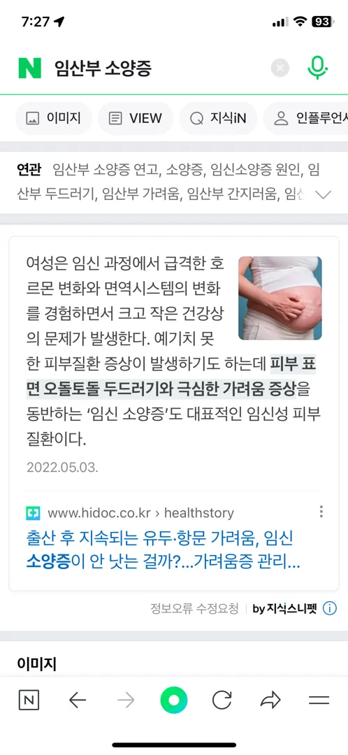 임산부 소양증 시작됐어요