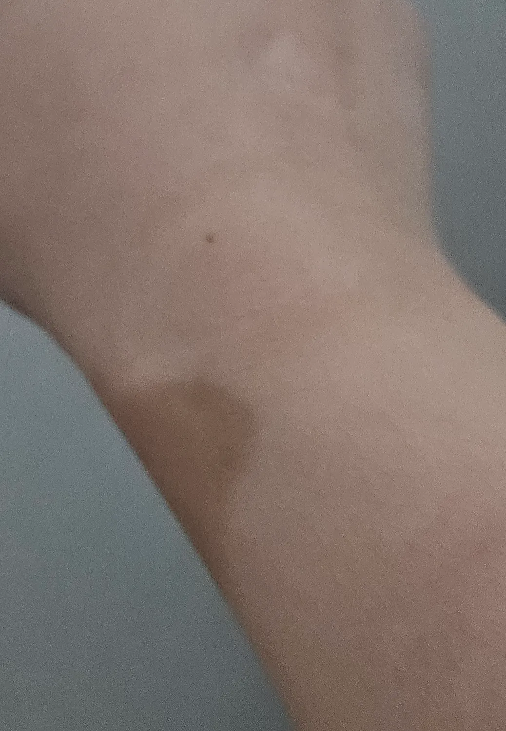 임신후 착색 손목에 생기신분 있나요??