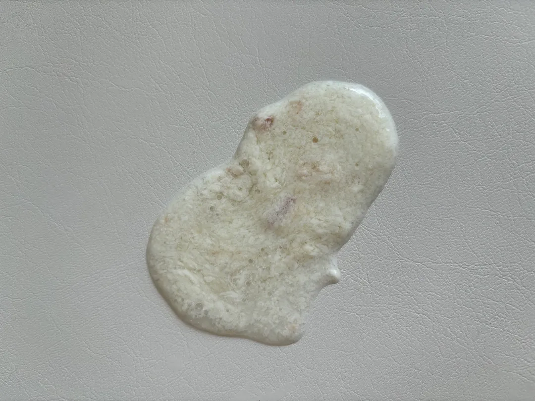 이유식 후 게워냄