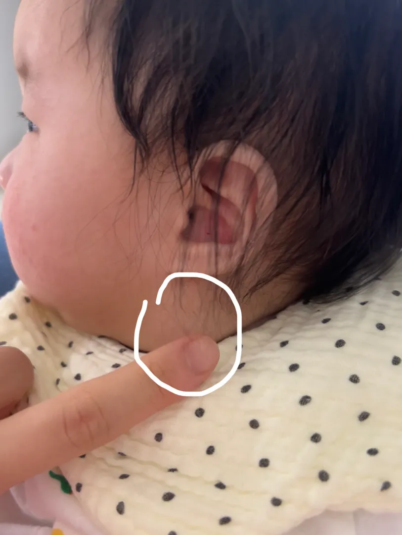 아기 고개 돌릴때 목..!