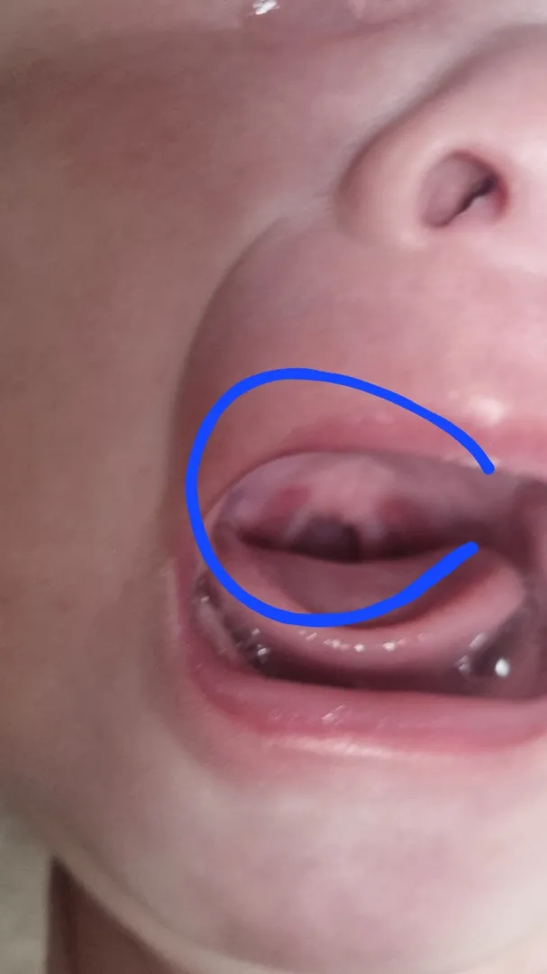 아기입안좀봐주세요