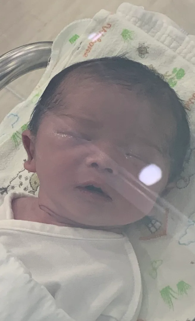 제왕절개 후기 가져왔어요(남아/39주1일/3.23kg/무통O, 페인버스터O, 유착방지제O)