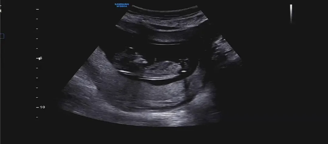 12주3일 각도법 봐주세요!