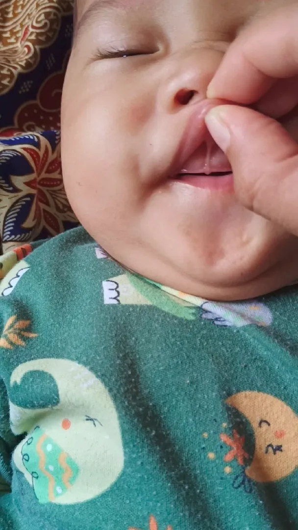 Bibir dan gusi bayi