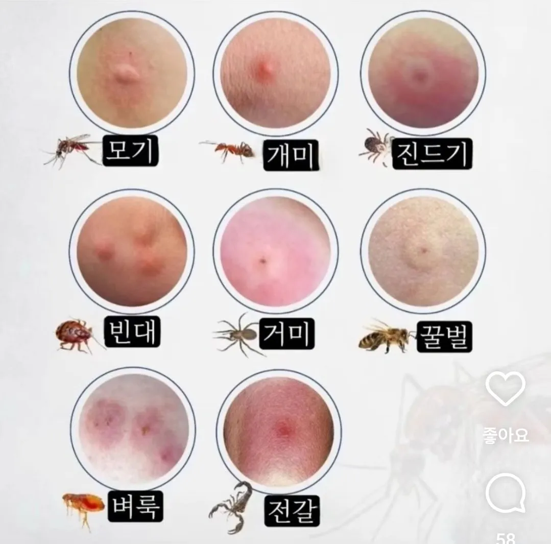 아기들 뭐에 물린건지 알수있어요