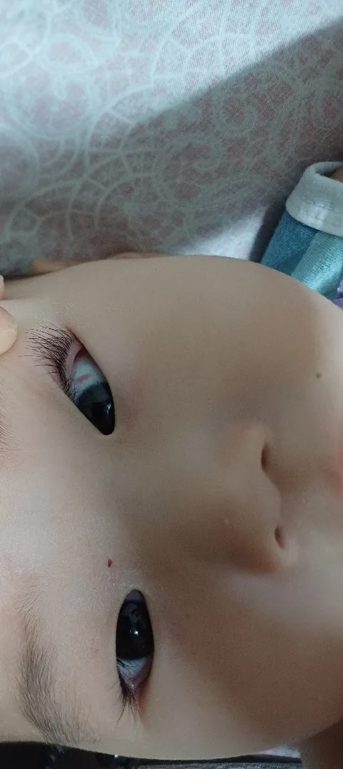 아기 눈 흰자에 빨간