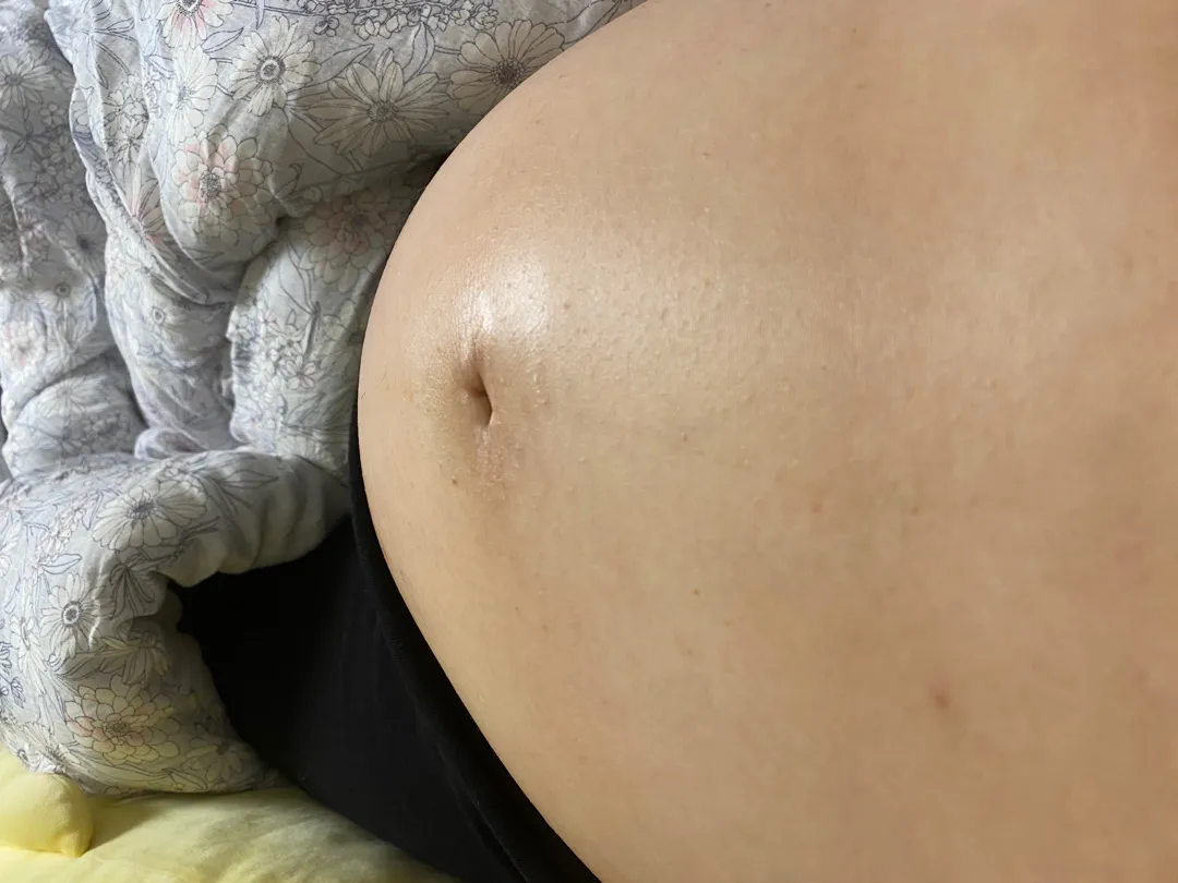 이런 배뭉침 괜찮은건가요? 