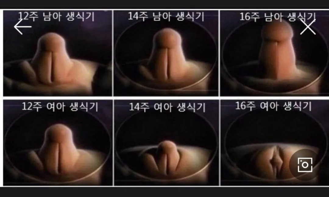 각도법 노노, 생식기참고자료이미지