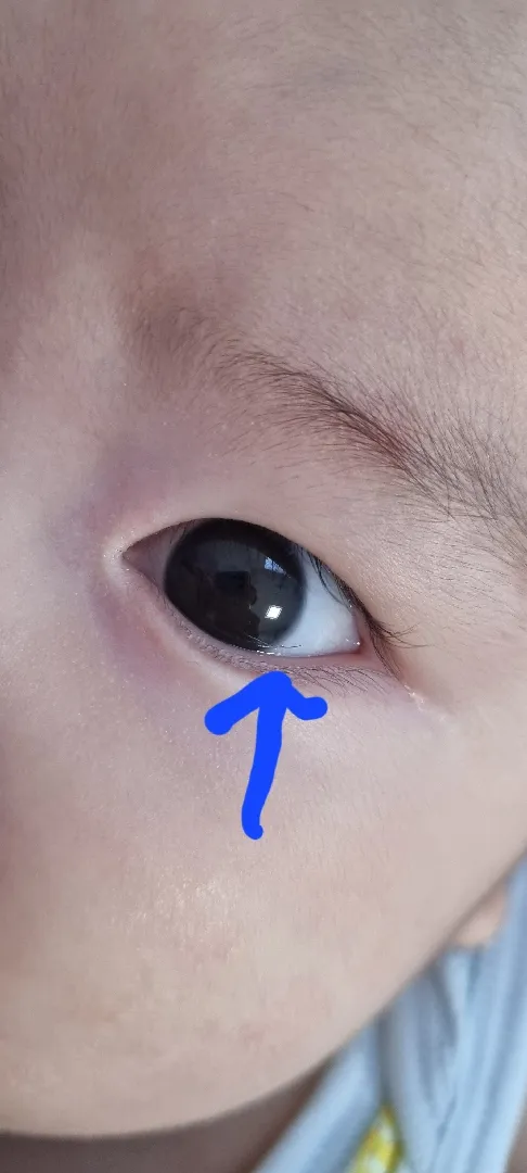 눈알에 속눈썹이 돌아다녀요😨