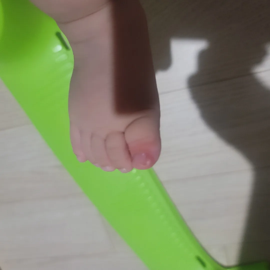 아기 내성발톱 문의ㅜㅜ