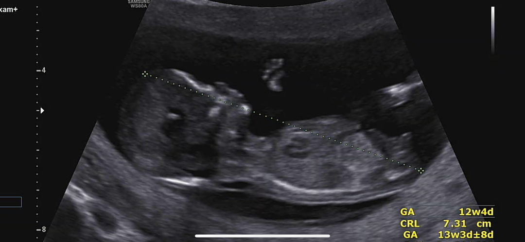 12주 4일 각도법 가볍게 봐주세요 :)