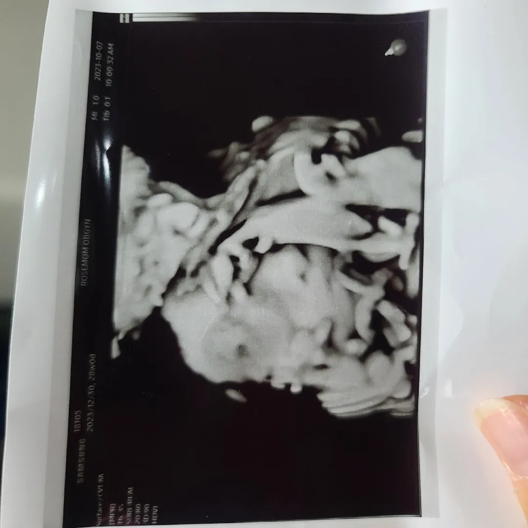 28주 입성