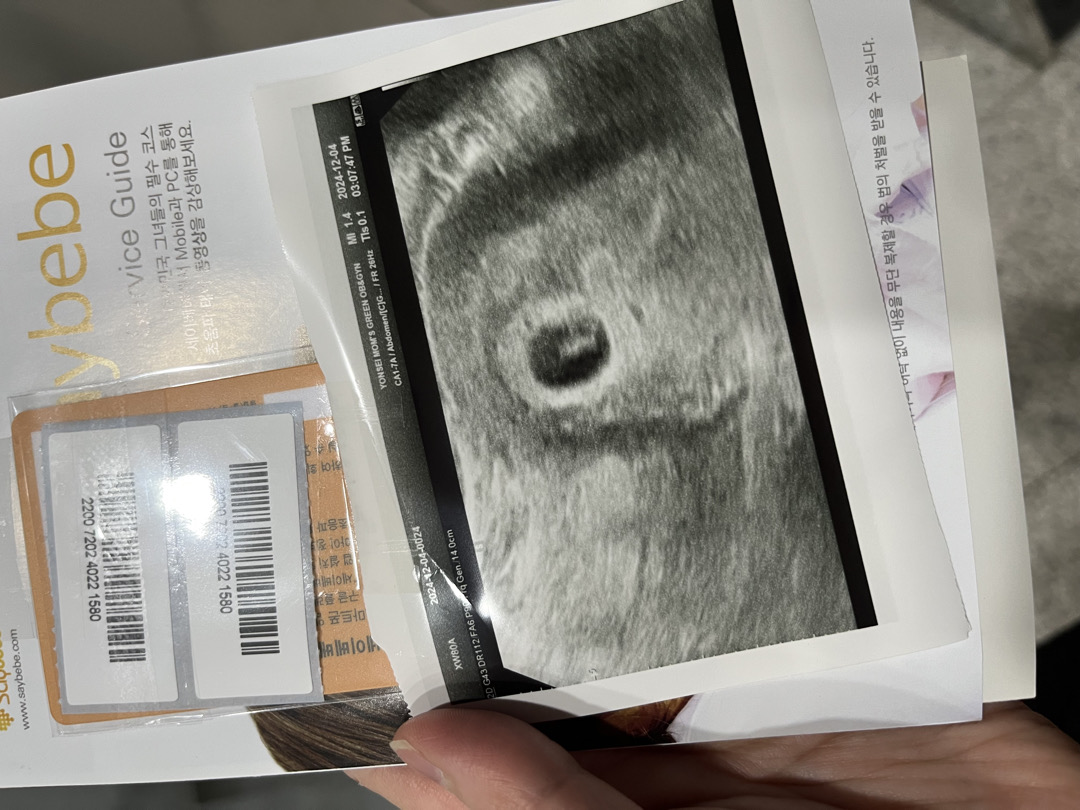 6주 5일 아기집이 작은건가요??