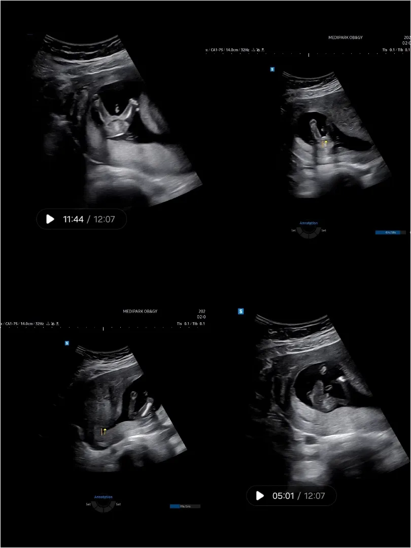community post image