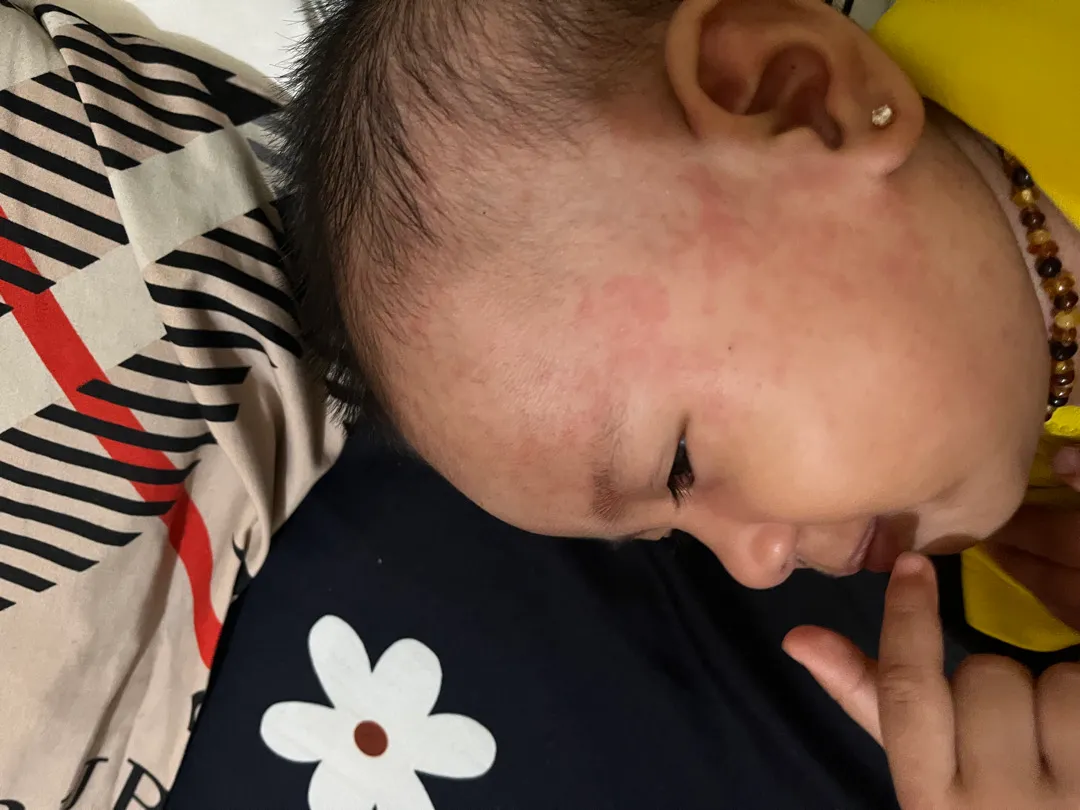 bun muka anak sy ini kenapa ya ?