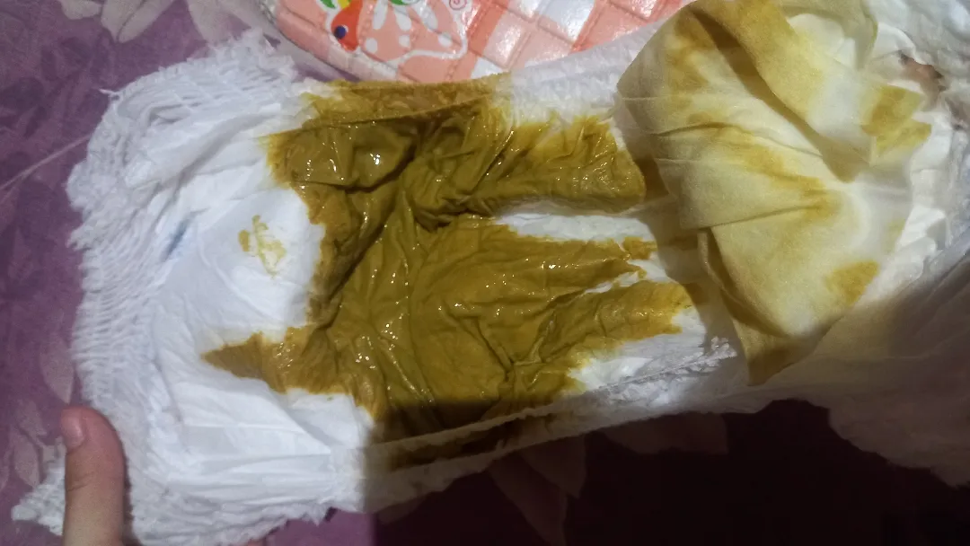 Bab (maaf rada jorok ya bun)