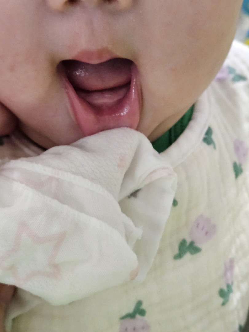 186일 아이 아랫니 나기 시작했는데