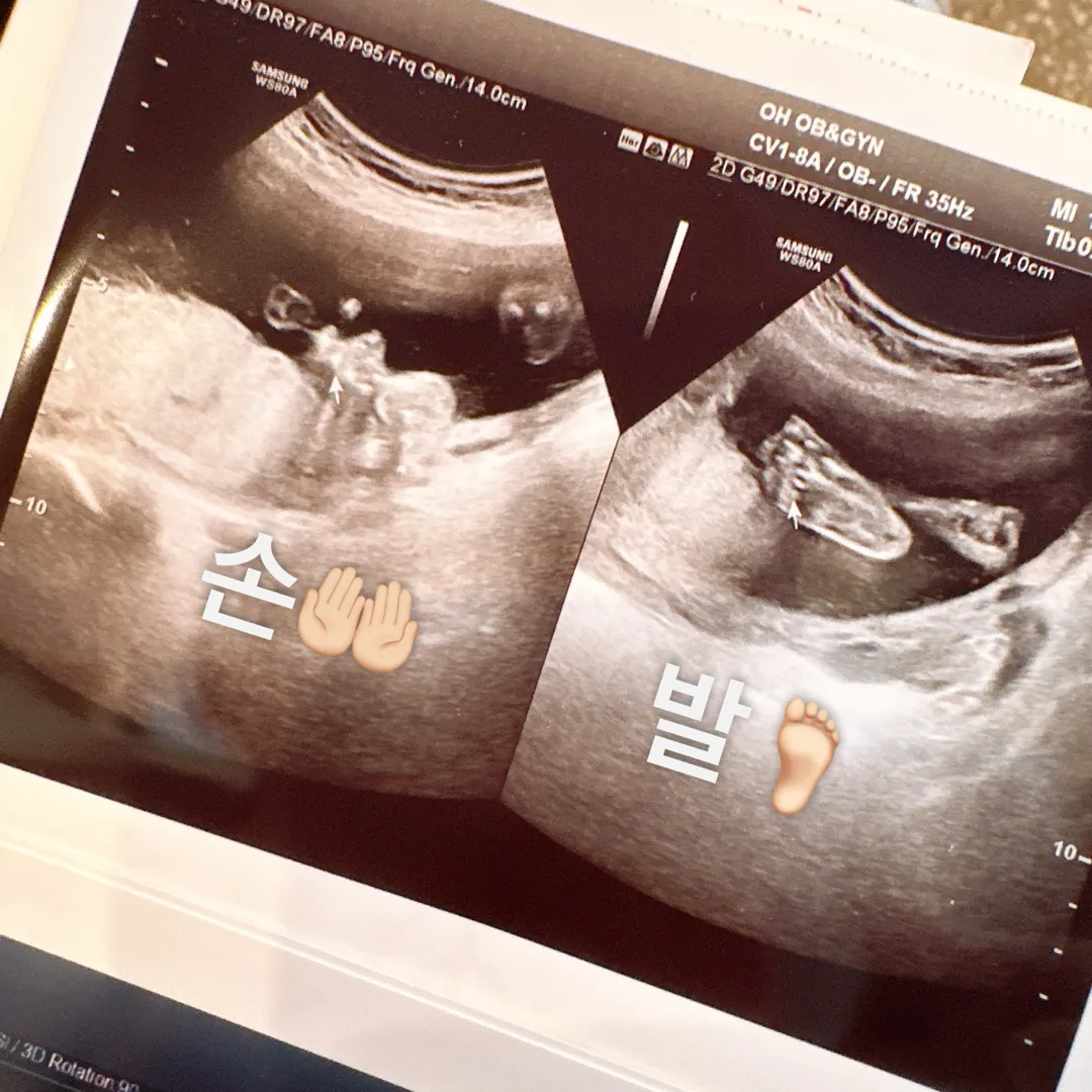 아가보면서 손,발도 보고왔어용!💗