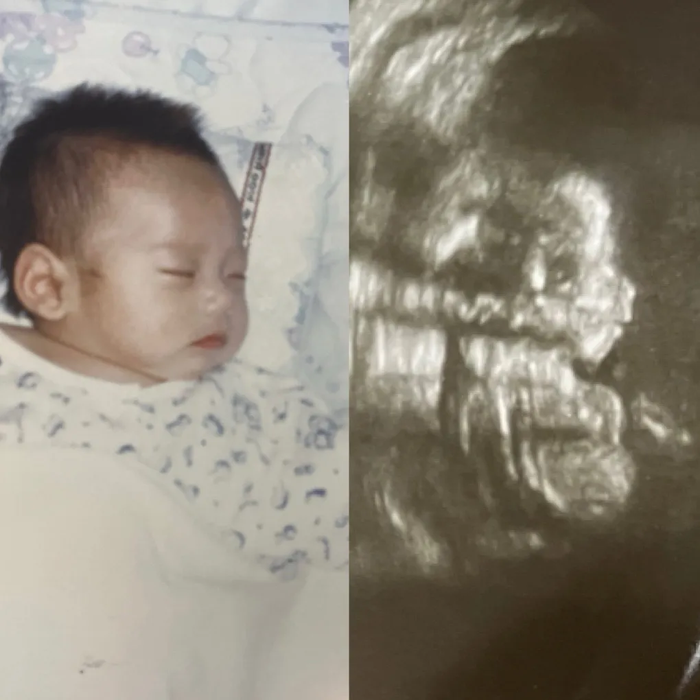 우리애기코는 아빠코닮았나?